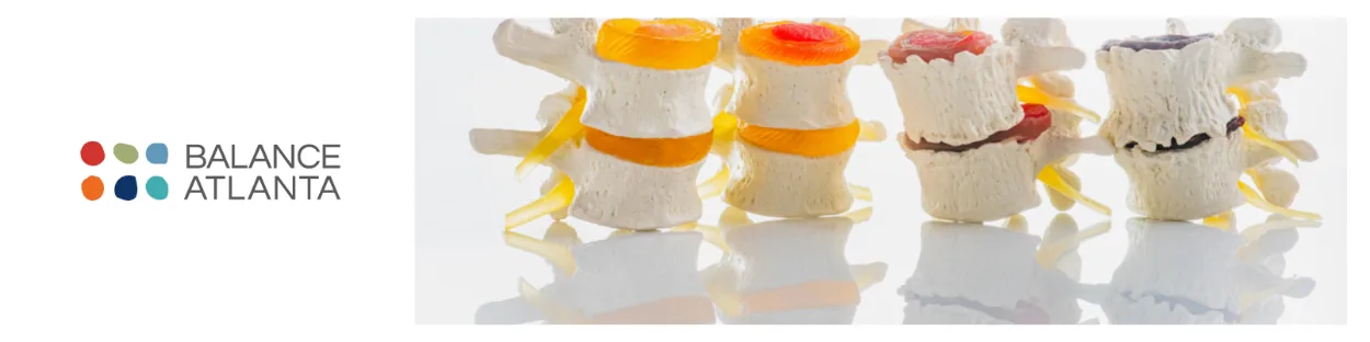 Balance Atlanta logo at left and four spinal vertebra models with colored intervertebral discs on a white reflective surface.