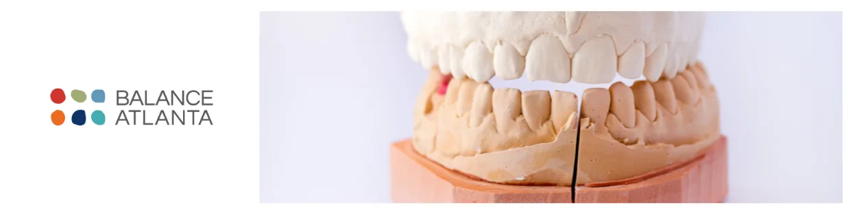Plaster dental models showing upper and lower teeth on a base, with the Balance Atlanta logo to the left.