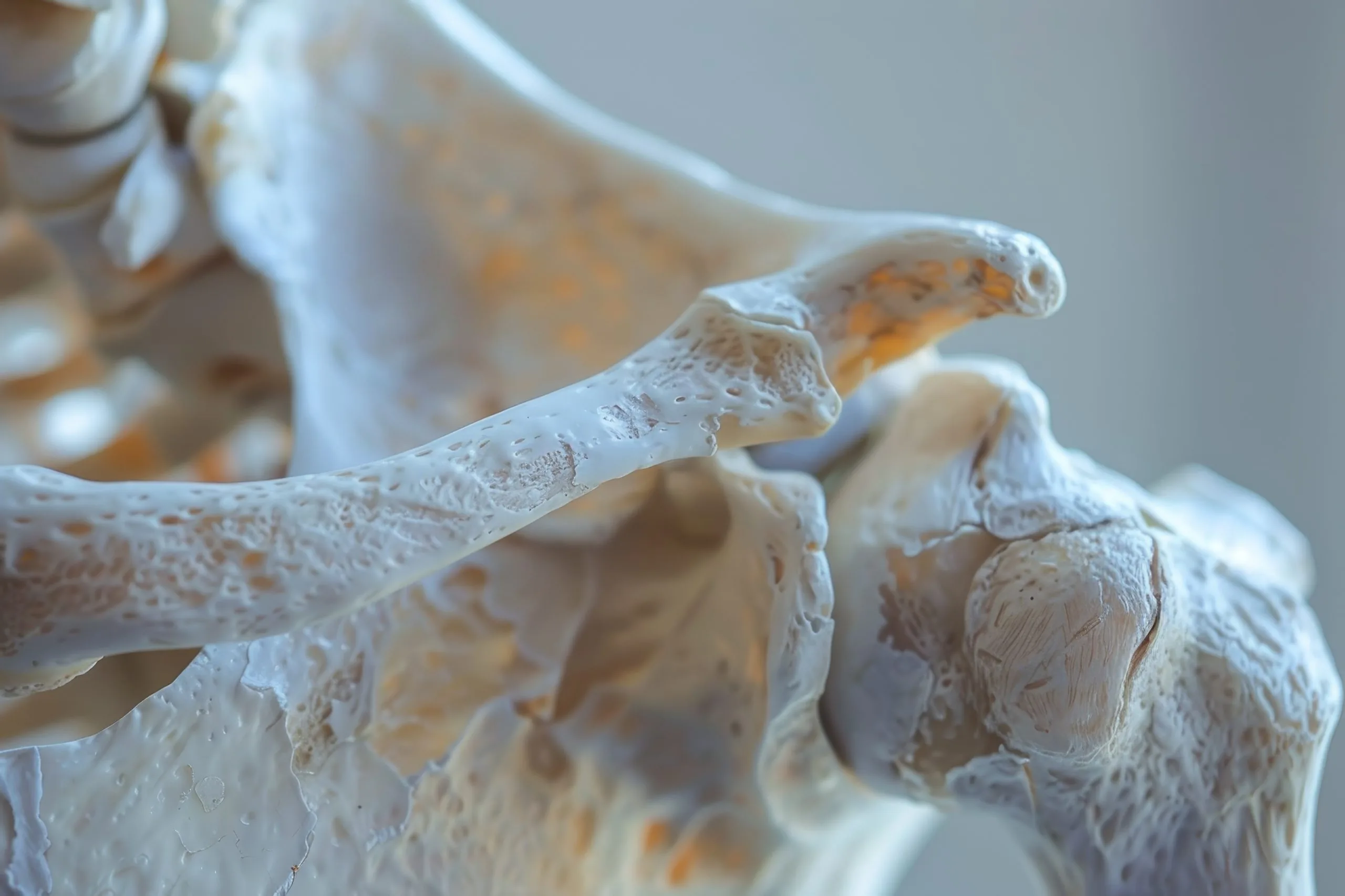 Close-up of a porous vertebra bone model showing surface erosion and small holes, illustrating bone degeneration associated with arthritis.