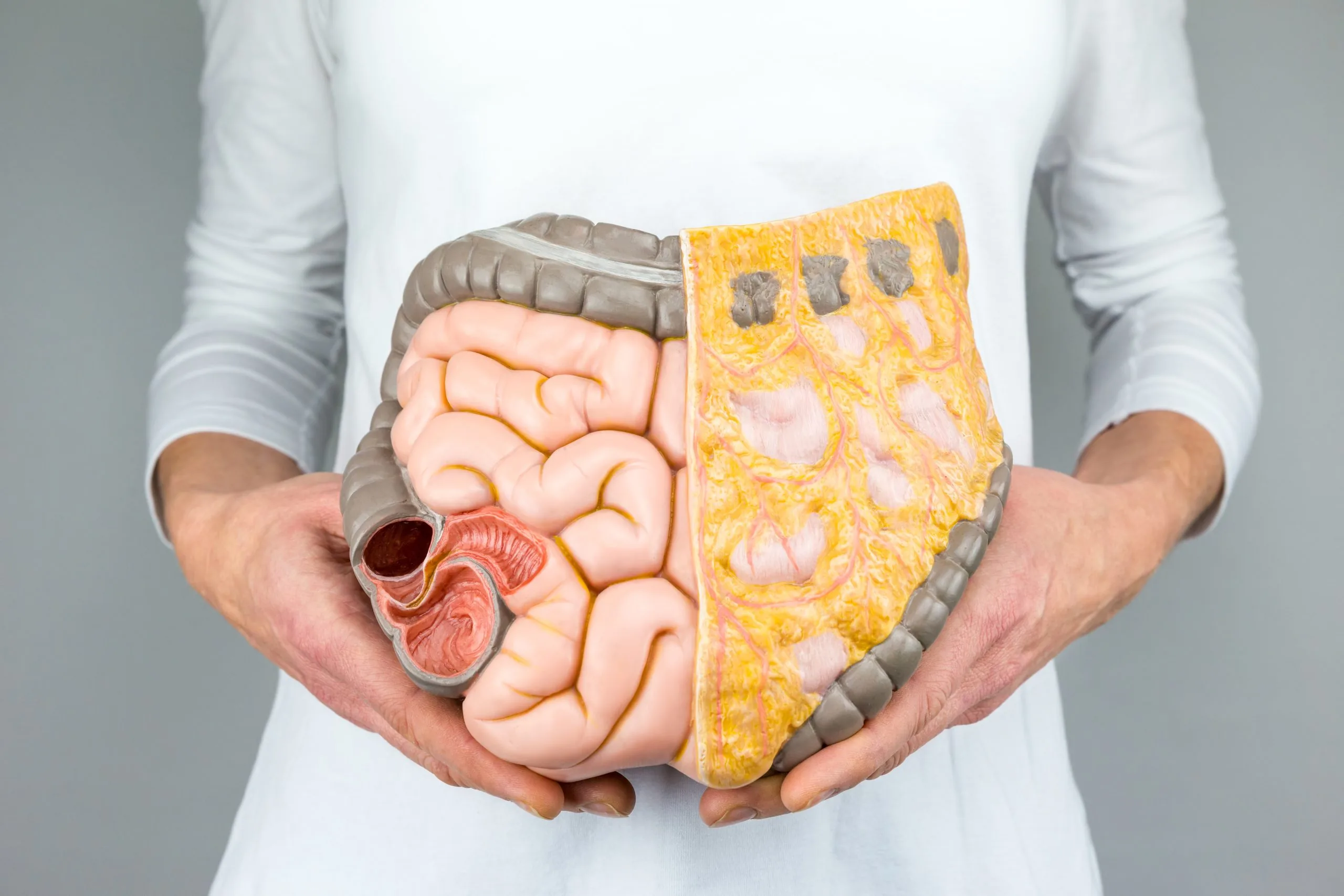 Person holding an anatomical model of the gut showing small intestine, colon, and sectioned abdominal tissue.