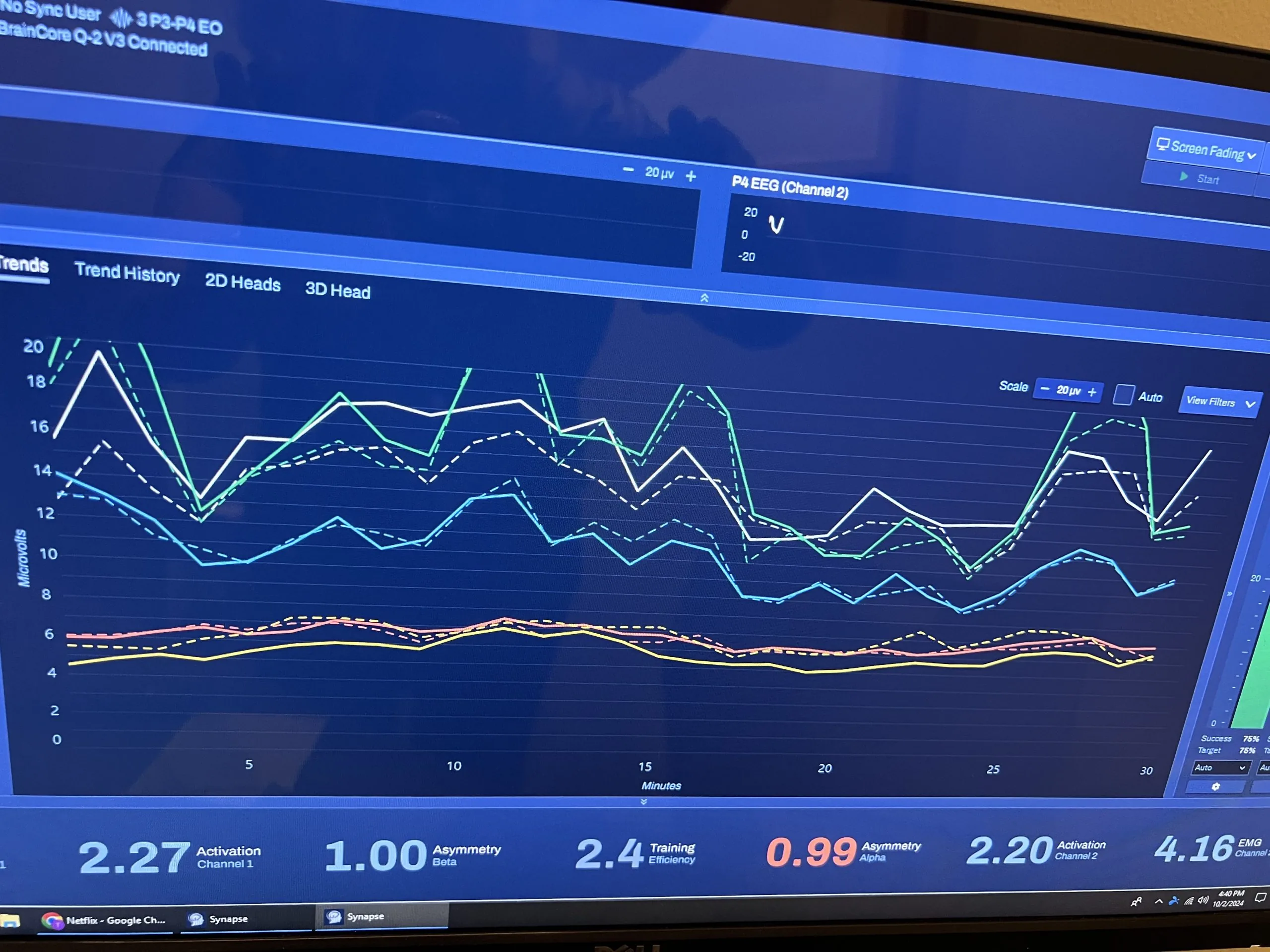 Computer screen showing EEG monitoring software with multicolored trend lines, scales, and numeric training/activation metrics.