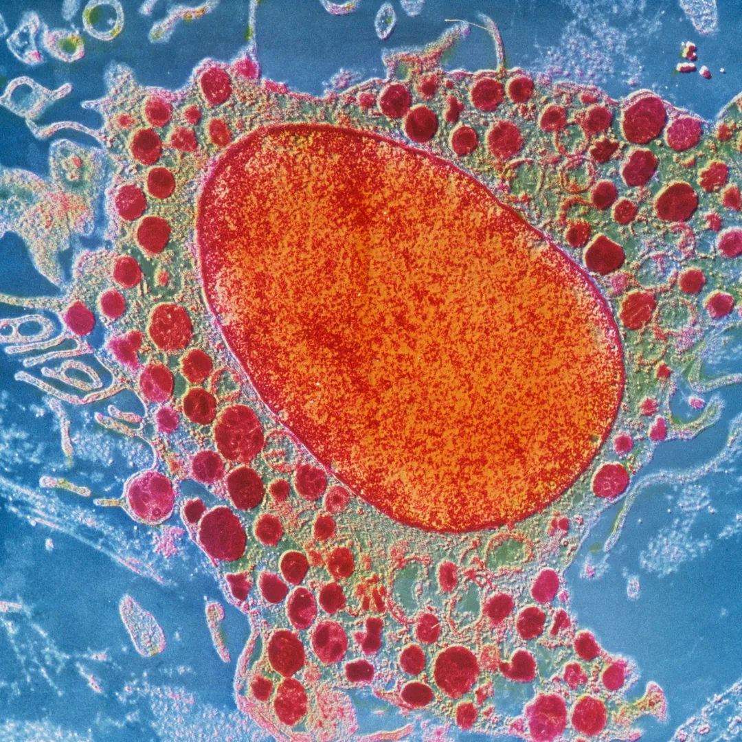 Colored microscope micrograph of a cell with a large central orange organelle surrounded by many small red vesicles, illustrating cellular structure relevant to longevity.