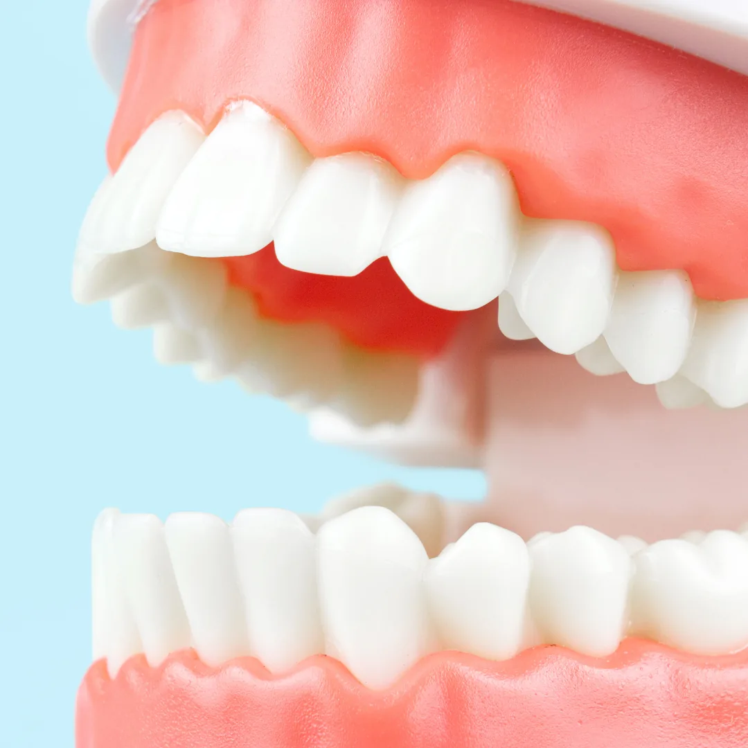 Close-up of a plastic dental model showing upper and lower teeth and gums slightly apart.