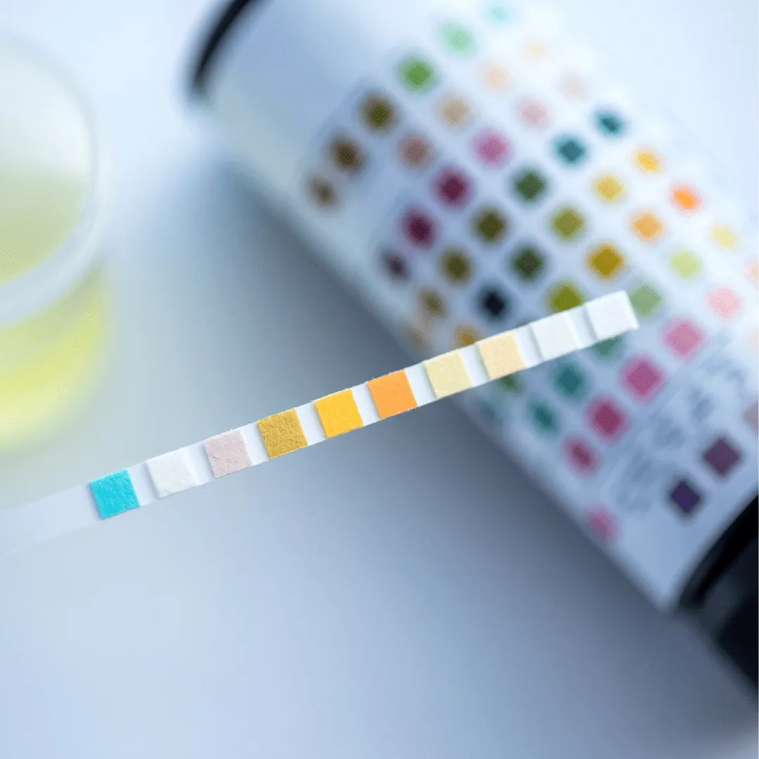 urine dipstick with colored reagent pads held horizontally, with a blurred color comparison chart and a small urine sample cup in the background